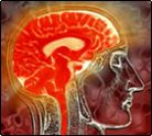 Brain Infection Injury Brain Infection Injury