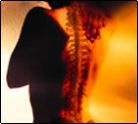 Back Injuries Lawyers Back Injuries Lawyers
